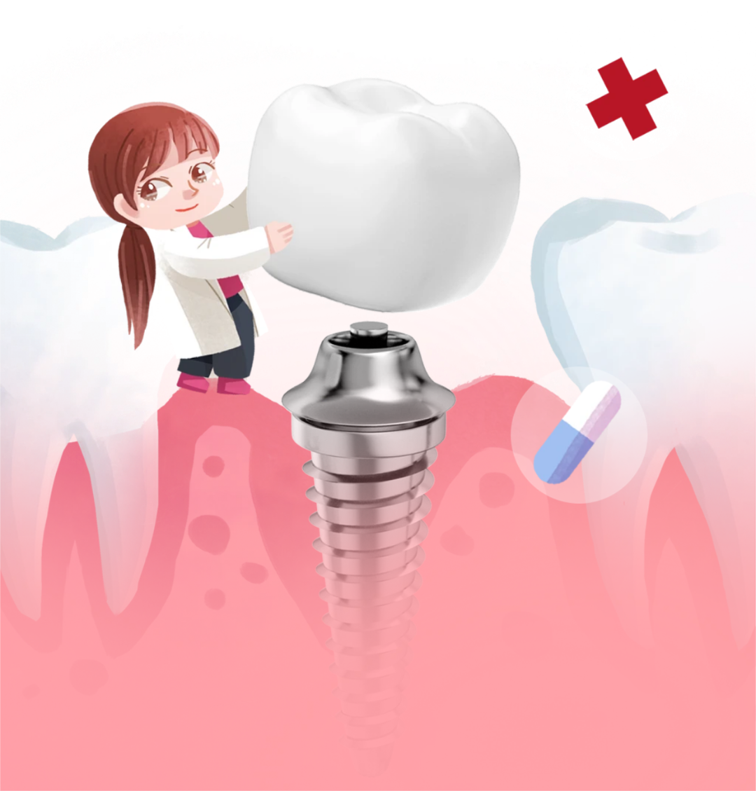 缺牙时间久了，还能做种植牙吗？